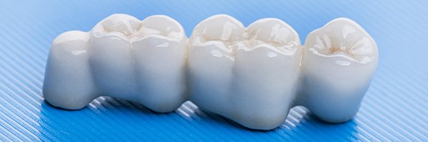 Broken Tooth Crown: When A Crown Can Save The Tooth 1 Dental crown treatment example for a damaged tooth