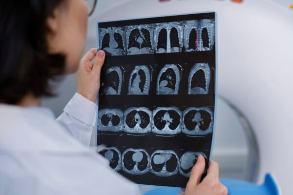 Dentist reviewing CBCT imaging for implant planning
