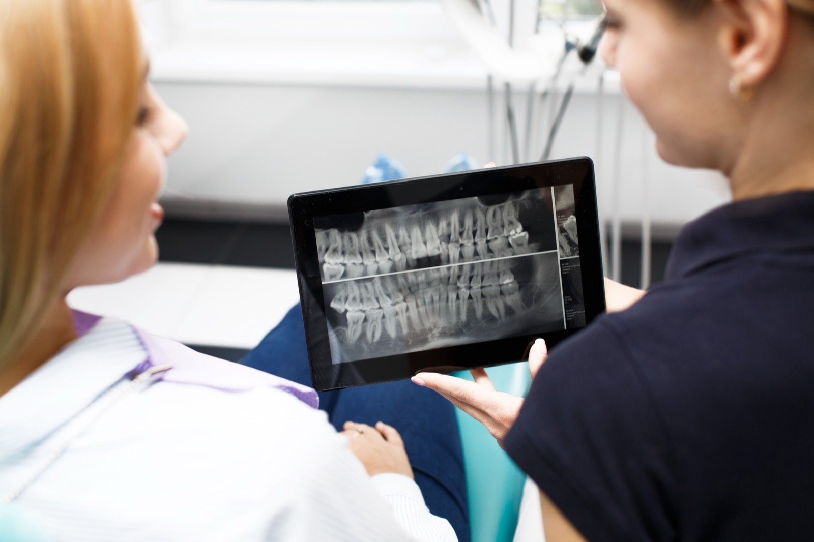 Dentist reviewing X-rays and dental costs with a patient
