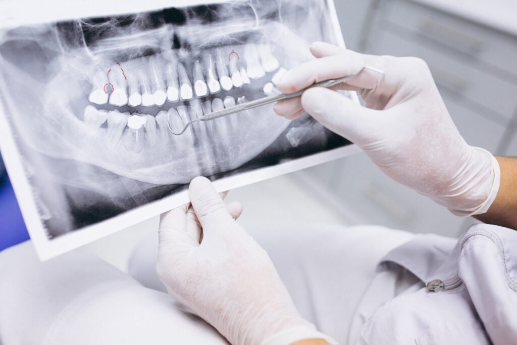 x ray teeth 1 scaled