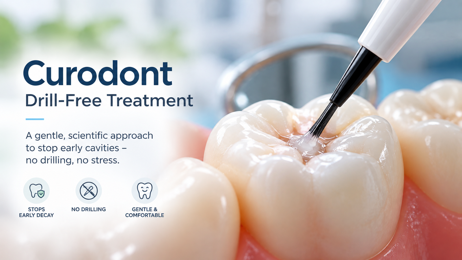 Can A Cavity Go Away? Curodont And Drill-Free Treatment 1 Curodont drill-free treatment illustration showing a brush applying treatment to a tooth